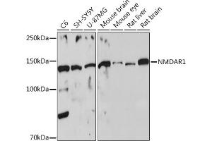 Western blot analysis of extracts of various cell lines, using NMD Rabbit pAb (ABIN6133733, ABIN6141400, ABIN6141403 and ABIN6223602) at 1:500 dilution.