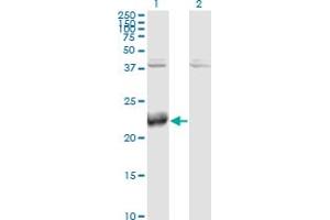Western Blot analysis of ATF3 expression in transfected 293T cell line by ATF3 monoclonal antibody (M04), clone 8G5. (ATF3 anticorps  (AA 1-181))