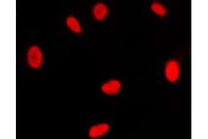 Immunofluorescent analysis of RXR gamma staining in NIH3T3 cells.