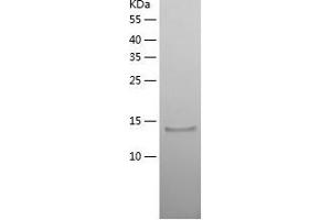 Western Blotting (WB) image for Vascular Endothelial Growth Factor A (VEGFA) (AA 27-146) protein (His-IF2DI Tag) (ABIN7125703)