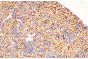 Immunohistochemistry of paraffin-embedded Rat spleen using CD44 Polycloanl Antibody at dilution of 1:200 (CD44 anticorps)