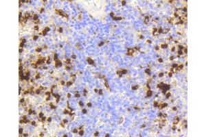 Immunohistochemistry of paraffin-embedded human spleen using LYZ antibody. (LYZ anticorps)