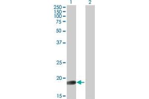 Western Blot analysis of GLYAT expression in transfected 293T cell line by GLYAT MaxPab polyclonal antibody. (GLYAT anticorps  (AA 1-163))