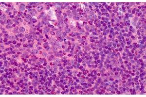 Human Tonsil: Formalin-Fixed, Paraffin-Embedded (FFPE) (TK1 anticorps  (N-Term))