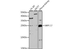 Western blot analysis of extracts of various cell lines, using MRPL17 antibody (ABIN7268559) at 1:1000 dilution.