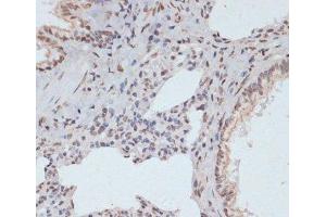 Immunohistochemistry of paraffin-embedded Rat lung using Phospho-ERK1(T202/Y204)/ ERK2(T185/Y187) Polyclonal Antibody at dilution of 1:100 (40x lens).