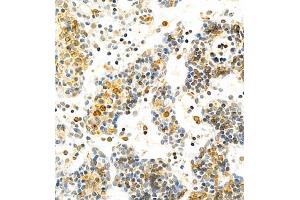 Immunohistochemistry of paraffin embedded mouse lymph node using MHC-II (ABIN7074245) at dilution of 1:1800 (400x lens)