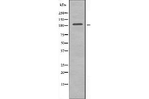 Western blot analysis of extracts from HT-29 cells, using DGKQ antibody. (DGKQ anticorps  (C-Term))