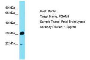 Image no. 1 for anti-phosphoglycerate Mutase 1 (Brain) (PGAM1) (C-Term) antibody (ABIN6750470) (PGAM1 anticorps  (C-Term))