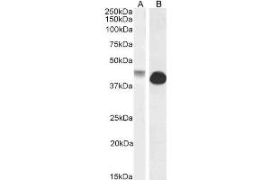 ABIN570972 (0. (Connexin 43/GJA1 anticorps  (Internal Region))