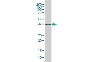AKR1B10 monoclonal antibody (M01), clone 1A6 Western Blot analysis of AKR1B10 expression in HepG2 .