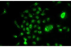 Immunofluorescence analysis of U2OS cells using NELFE Polyclonal Antibody (RDBP anticorps)