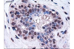 Immunohistochemical staining of paraffin-embedded breast using anti-HES1 (TA000114) mouse monoclonal antibody.
