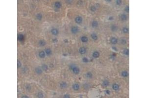 IHC-P analysis of Rat Tissue, with DAB staining. (Prothrombin anticorps  (AA 44-200))