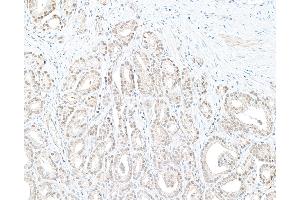 Immunohistochemistry (IHC) image for anti-Denticleless E3 Ubiquitin Protein Ligase Homolog (DTL) (C-Term) antibody (ABIN7454696) (CDT2/RAMP anticorps  (C-Term))