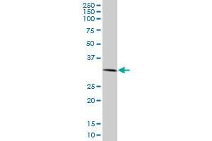RNF2 monoclonal antibody (M09), clone 4A12. (RNF2 anticorps  (AA 192-290))