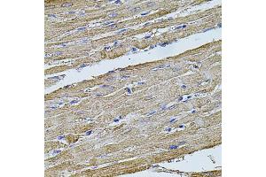 Immunohistochemistry of paraffin-embedded rat heart using FLNB antibody. (FLNB anticorps)