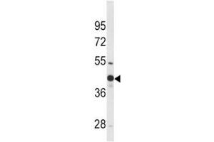 Western blot analysis of WNT4 antibody and mouse bladder tissue lysate.