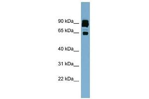CLPTM1L antibody used at 1 ug/ml to detect target protein.
