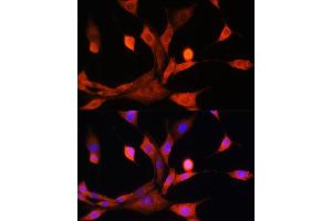 Immunofluorescence analysis of NIH/3T3 cells using ADK Rabbit pAb  at dilution of 1:100.