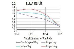 Black line: Control Antigen (100 ng),Purple line: Antigen (10 ng), Blue line: Antigen (50 ng), Red line:Antigen (100 ng)