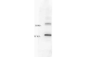 Anti IL-10 whole antiserum  was tested against recombinant IL10. (IL-10 anticorps)