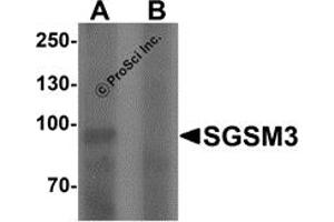 Western Blotting (WB) image for anti-Small G Protein Signaling Modulator 3 (SGSM3) (N-Term) antibody (ABIN1077375) (SGSM3 anticorps  (N-Term))
