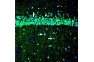 Expression of KCNQ3 in rat hippocampus - Immunohistochemical staining of perfusion-fixed frozen rat brain sections with Anti-KCNQ3 Antibody (ABIN7043505, ABIN7044961 and ABIN7044962), (1:200), followed by goat anti-rabbit-AlexaFluor-488.