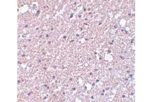 Immunohistochemistry staining of human brain tissue (Paraffin section) with TMEM184A Antibody   at 5 μg/ml. (TMEM184A anticorps  (C-Term))