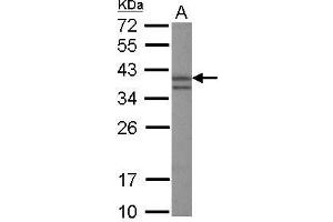 WB Image Sample (30 ug of whole cell lysate) A: HeLa nucleus 12% SDS PAGE antibody diluted at 1:3000