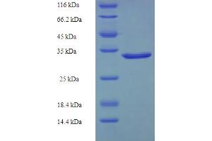 Growth Arrest and DNA-Damage-Inducible, gamma (GADD45G) (AA 1-159), (full length) protein (His-SUMO Tag)