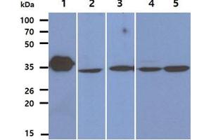 The Recombinant Human LDHB (50ng) and Cell lysates (40ug) were resolved by SDS-PAGE, transferred to PVDF membrane and probed with anti-human LDHB antibody (1:1000). (LDHB anticorps)