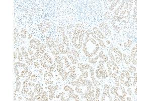 Immunohistochemistry (IHC) image for anti-Jun Dimerization Protein 2 (JDP2) (AA 50-100) antibody (ABIN7795636) (Recombinant JDP2 anticorps  (AA 50-100))