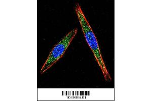 Confocal immunofluorescent analysis of LCK Antibody with A2058 cell followed by Alexa Fluor 488-conjugated goat anti-rabbit lgG (green). (LCK anticorps  (N-Term))