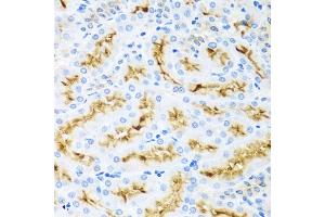 Immunohistochemistry of paraffin-embedded rat kidney using CCL22 antibody (ABIN5974972) at dilution of 1/100 (40x lens). (CCL22 anticorps)
