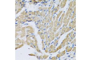Immunohistochemistry of paraffin-embedded mouse heart using CRHBP antibody at dilution of 1:100 (40x lens). (CRHBP anticorps)