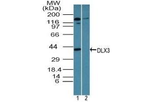 Image no. 1 for anti-Distal-Less Homeobox 3 (DLX3) (AA 220-270) antibody (ABIN960137)