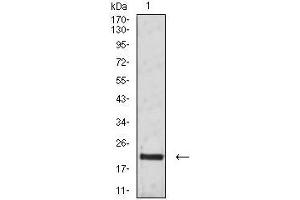 Western blot analysis using CD3G mouse mAb against Jurkat (1) cell lysate. (CD3G anticorps  (AA 23-116))