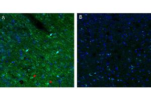 Free-floating frozen brain sections from a paraformaldehyde-perfused mouse were incubated with Anti-CFTR Antibody (ABIN7043096, 1:300), followed by goat anti-rabbit secondary antibody conjugated to Alexa Fluor® 488 (green).