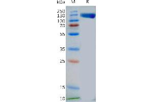 Human Protein, mFc Tag on SDS-PAGE under reducing condition.