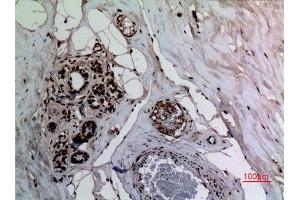 Immunohistochemistry (IHC) analysis of paraffin-embedded Human Breast, antibody was diluted at 1:100.