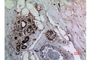 Immunohistochemistry (IHC) analysis of paraffin-embedded Human Breast, antibody was diluted at 1:100. (NF-kB p65 anticorps  (acLys314, acLys315))