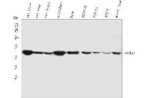 Western blot analysis of ACAA2 using anti-ACAA2 antibody (ABIN4886414). (ACAA2 anticorps  (Middle Region))