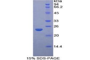 SDS-PAGE analysis of Rat LMP7 Protein. (PSMB8 Protéine)