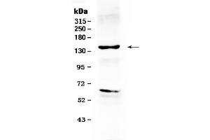Western blot analysis of ErbB 2 using anti- ErbB 2 antibody . (ErbB2/Her2 anticorps  (N-Term))