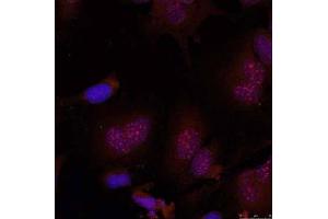 Immunofluorescence staining of methanol-fixed HeLa cells using JunB (Phospho-Ser79) Antibody (E011026, Red) (JunB anticorps  (pSer79))