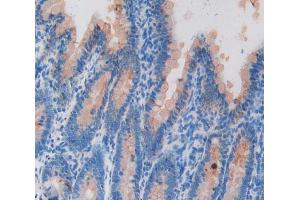Used in DAB staining on fromalin fixed paraffin- embedded intestine tissue (KRT20 anticorps  (AA 75-382))