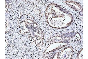 IHC analysis of MCM6 using anti-MCM6 antibody (ABIN7600038).