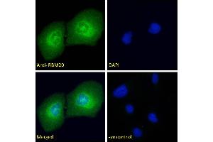 ABIN571262 Immunofluorescence analysis of paraformaldehyde fixed U2OS cells, permeabilized with 0. (RBM20 anticorps  (AA 717-727))