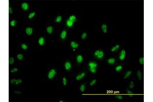 Image no. 1 for anti-GA Binding Protein Transcription Factor, alpha Subunit 60kDa (GABPA) (AA 1-101) antibody (ABIN598704)